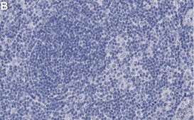 Anti-STAT5B Antibody, clone 2G13 ZooMAb® Rabbit Monoclonal recombinant, expressed in HEK 293 cells