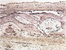 Anti-Osteopontin Antibody serum, Chemicon®