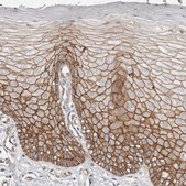 抗-CTNNB1 兔抗 Prestige Antibodies® Powered by Atlas Antibodies, affinity isolated antibody, buffered aqueous glycerol solution