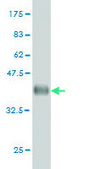 Monoclonal Anti-MT antibody produced in mouse clone 2F2, purified immunoglobulin, buffered aqueous solution