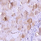 Anti-GAPDH antibody produced in rabbit Prestige Antibodies® Powered by Atlas Antibodies, affinity isolated antibody, buffered aqueous glycerol solution