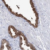 Anti-PGM3 antibody produced in rabbit Prestige Antibodies® Powered by Atlas Antibodies, affinity isolated antibody, buffered aqueous glycerol solution, ab1