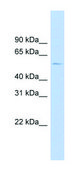 Anti-HTR2B (N-terminal) antibody produced in rabbit affinity isolated antibody