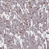 Anti-PKP2 antibody produced in rabbit Prestige Antibodies® Powered by Atlas Antibodies, affinity isolated antibody