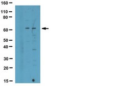 抗氧化-CaM激酶II（Met281/282）抗体 serum, from rabbit