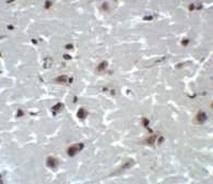 Anti-CD81 antibody produced in rabbit affinity isolated antibody