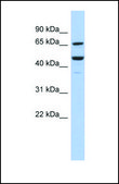 Anti-SF1 antibody produced in rabbit affinity isolated antibody