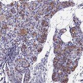 Anti-TRPM7 antibody produced in rabbit Prestige Antibodies® Powered by Atlas Antibodies, affinity isolated antibody