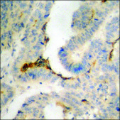 Anti-phospho-STAT2 (pTyr690) antibody produced in rabbit affinity isolated antibody