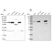 Anti-GBE1 antibody produced in rabbit Prestige Antibodies® Powered by Atlas Antibodies, affinity isolated antibody, buffered aqueous glycerol solution
