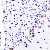 Anti- RBBP4 antibody produced in rabbit