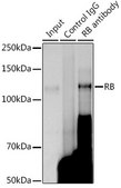 Anti- RB antibody produced in rabbit