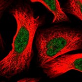 Anti-DDB1 antibody produced in rabbit Prestige Antibodies® Powered by Atlas Antibodies, affinity isolated antibody, buffered aqueous glycerol solution