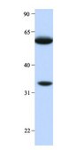 Anti-HRG antibody produced in rabbit affinity isolated antibody