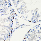 Anti-SOX9 antibody produced in rabbit