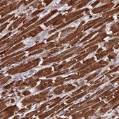 Anti-CS antibody produced in rabbit Prestige Antibodies® Powered by Atlas Antibodies, affinity isolated antibody, buffered aqueous glycerol solution