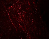 Anti-FGFR3 antibody produced in rabbit affinity isolated antibody