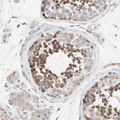 Anti-FAAH antibody produced in rabbit Prestige Antibodies® Powered by Atlas Antibodies, affinity isolated antibody, buffered aqueous glycerol solution
