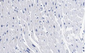 Anti-GLUT-4 Antibody, clone 1M13 ZooMAb® Rabbit Monoclonal recombinant, expressed in HEK 293 cells