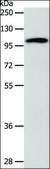 Anti-ADCY1 antibody produced in rabbit affinity isolated antibody