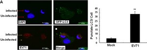 Anti-LC3B antibody produced in rabbit ~1 mg/mL, affinity isolated antibody, buffered aqueous solution