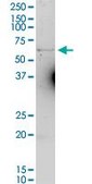Anti-SLC40A1 antibody produced in rabbit purified immunoglobulin, buffered aqueous solution