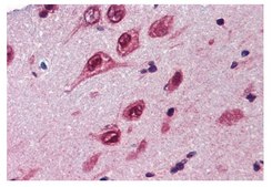 Anti-UBQLN1 antibody produced in rabbit affinity isolated antibody