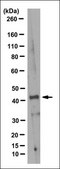 Anti-G-CSF-R/CD114 Antibody, clone 5A11.1 clone 5A11.1, from mouse