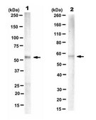 抗-PTB抗体，克隆BB7 clone Bb7, from mouse