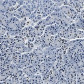 Anti-BNIP3L antibody produced in rabbit Prestige Antibodies® Powered by Atlas Antibodies, affinity isolated antibody, buffered aqueous glycerol solution