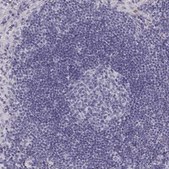 ANTI-NPTXR antibody produced in rabbit Prestige Antibodies® Powered by Atlas Antibodies, affinity isolated antibody, buffered aqueous glycerol solution