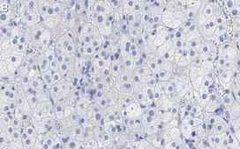 Anti-SCARB1 Antibody, clone 3B15 ZooMAb® Rabbit Monoclonal recombinant, expressed in HEK 293 cells