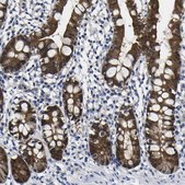 Anti-CASP6 antibody produced in rabbit Prestige Antibodies® Powered by Atlas Antibodies, affinity isolated antibody, buffered aqueous glycerol solution
