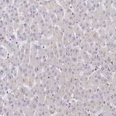 Anti-PPP2R2B antibody produced in rabbit Prestige Antibodies® Powered by Atlas Antibodies, affinity isolated antibody, buffered aqueous glycerol solution
