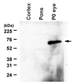抗-RalDH2（ALDH1A2）抗体 from rabbit, purified by affinity chromatography