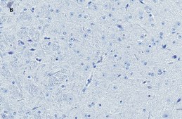 Anti-NeuN Antibody, clone 13E6, ZooMAb® Rabbit Monoclonal recombinant, expressed in HEK 293 cells