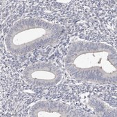 Anti-SPTA1 antibody produced in rabbit Prestige Antibodies® Powered by Atlas Antibodies, affinity isolated antibody, buffered aqueous glycerol solution