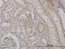 Monoclonal Anti-CLPP antibody produced in mouse clone 300, purified immunoglobulin, buffered aqueous solution