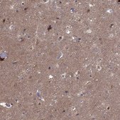 Anti-CDK5 antibody produced in rabbit Prestige Antibodies® Powered by Atlas Antibodies, affinity isolated antibody