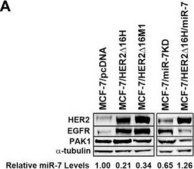 Anti-α-Tubulin Antibody, clone DM1A clone DM1A, Upstate®, from mouse