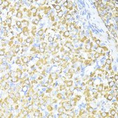 Anti-SQSTM1/p62 antibody produced in rabbit