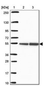 Anti-RBBP4 antibody produced in rabbit Prestige Antibodies® Powered by Atlas Antibodies, affinity isolated antibody, buffered aqueous glycerol solution