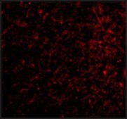 Anti-Nicastrin (ab1) antibody produced in rabbit IgG fraction of antiserum, buffered aqueous solution