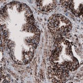 Monoclonal Anti-CS antibody produced in mouse Prestige Antibodies® Powered by Atlas Antibodies, clone CL2548, purified immunoglobulin, buffered aqueous glycerol solution