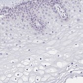 Anti-CACNA1S antibody produced in rabbit Prestige Antibodies® Powered by Atlas Antibodies, affinity isolated antibody, buffered aqueous glycerol solution