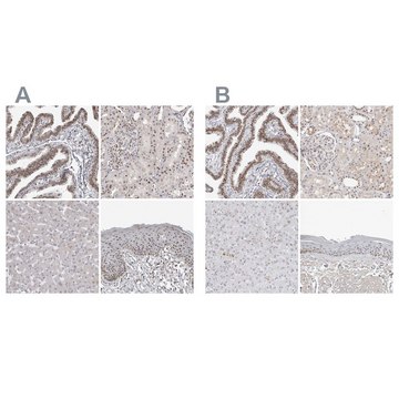 Anti-WRAP53 antibody produced in rabbit Prestige Antibodies® Powered by Atlas Antibodies, affinity isolated antibody, buffered aqueous glycerol solution