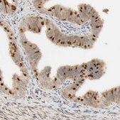 Anti-FMO1 antibody produced in rabbit Prestige Antibodies® Powered by Atlas Antibodies, affinity isolated antibody, buffered aqueous glycerol solution