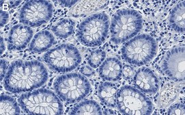 Anti-FOXA2 Antibody, clone 1H12 ZooMAb® Rabbit Monoclonal recombinant, expressed in HEK 293 cells