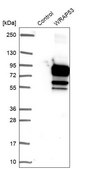 Anti-WRAP53 antibody produced in rabbit Prestige Antibodies® Powered by Atlas Antibodies, affinity isolated antibody, buffered aqueous glycerol solution