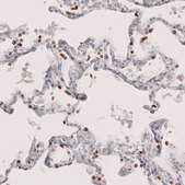 Monoclonal Anti-Nkx2-1 Antibody Produced In Mouse Prestige Antibodies® Powered by Atlas Antibodies, clone CL14528, affinity isolated antibody, buffered aqueous glycerol solution